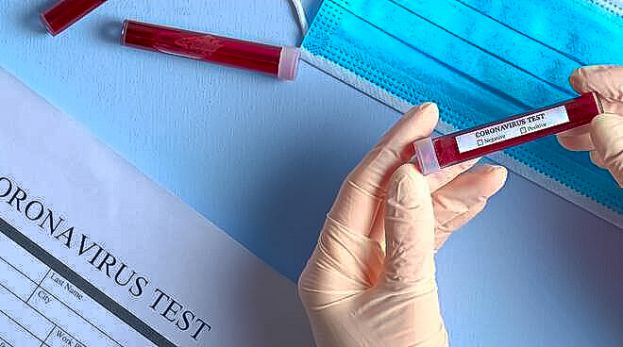 Test Coronavirus