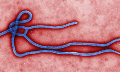 648x364 Ebola Virus and Disease
