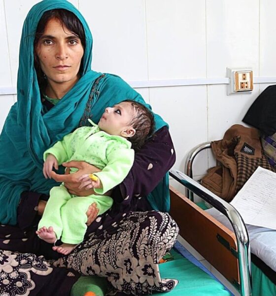 La fame minaccia i bambini in Afghanistan